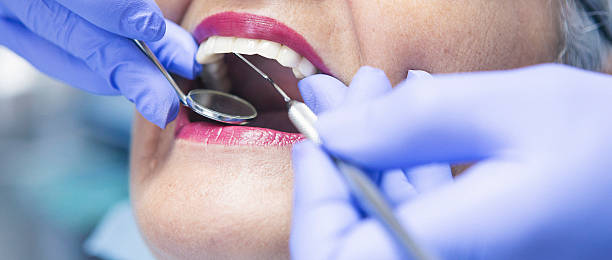 Best Emergency Treatment for Dental Infections or Abscesses in Kingston, IL